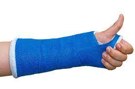 IDR Synthetic Casting Tape - Medilite