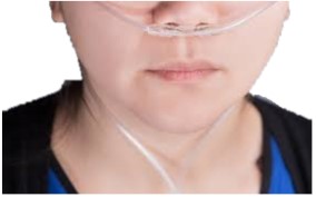 Nasal cannula